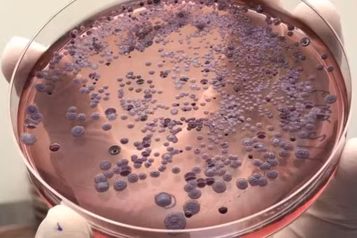 Thái Lan đối mặt dịch sốt đất nguy hiểm, hơn 40% ca tử vong