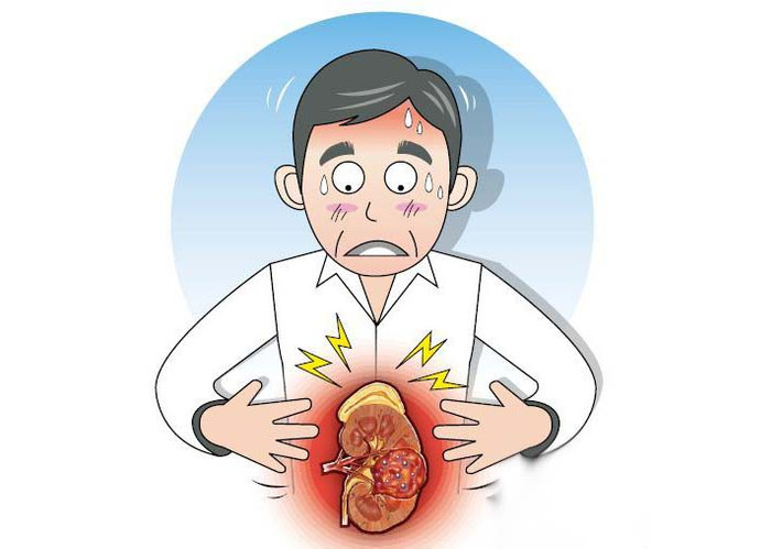 Sau khi bạn xạ trị, nên kiêng ăn các thức có tính nhiệt hại đến âm khí như thịt dê, thịt chó, thịt gà.