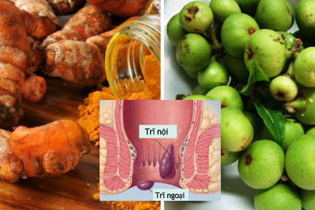 Nguyên liệu bài thuốc cần chuẩn bị: 1 củ nghệ tươi, 1 nắm to rau diếp cá tươi, 3 quả sung, 1 thìa cà phê muối hạt và 2 lít nước lọc.
