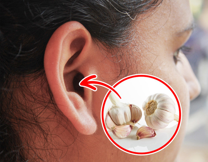 Tỏi có đặc tính giảm đau và là một loại kháng sinh giúp giảm đau tai. Giã vài tép tỏi và lấy nước nhỏ vào tai đau. Ngoài ra, bạn có thể đun nóng một muỗng cà phê tỏi băm với 2 muỗng canh dầu mè. Làm nguội dầu và lọc bã, bôi 2 đến 3 giọt vào tai khi bị đau.
