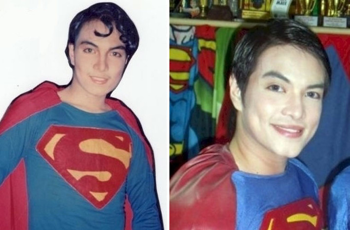 Sau mỗi một lần phẫu thuật thẩm mỹ, Chavez lại giống Superman thêm một chút.