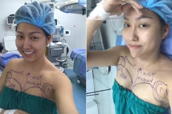 Trải qua hàng loạt cơn đau đớn hậu thẩm mỹ, "nữ hoàng dao kéo" tái xuất với làn da trắng, đôi mắt to tròn và cằm nhọn. Ảnh: FBNV.