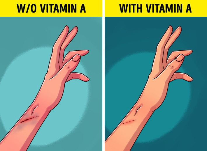 Vết thương lâu lành: Cơ thể nhanh lành vết thương nhờ sự sản sinh collagen. Vitamin A giúp cơ thể sản sinh ra collagen, do đó nếu thấy vết thương trên da lâu lành thì bạn nên kiểm tra xem chế độ dinh dưỡng có nạp đủ vitamin A hay không.