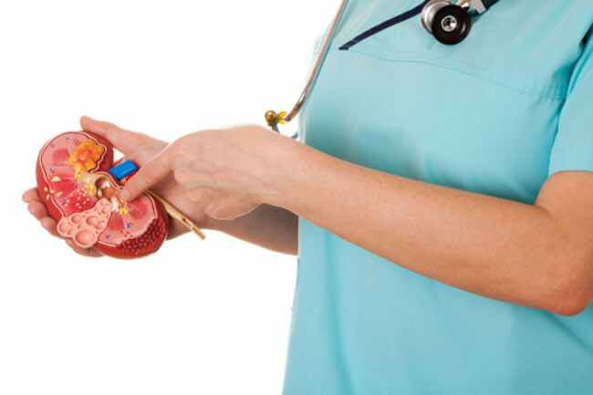 Các triệu chứng ban đầu: Một số loại sỏi thận không biểu hiện triệu chứng. Tuy nhiên, bạn vẫn có thể phát hiện các dấu hiệu cảnh báo ban đầu của sỏi thận.