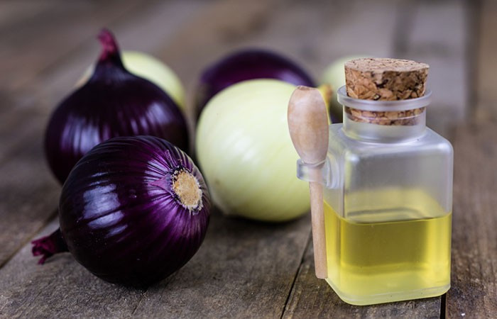 Nước hành. Nửa củ hành, cho vào máy ép để chiết lấy nước, sau đó thoa lên da đầu và để khoảng 1 giờ rồi rửa sạch. Thực hiện 2 lần/tuần.