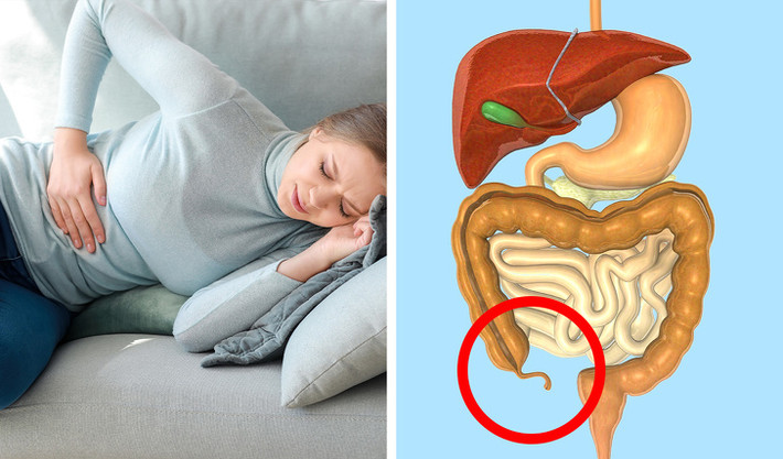 Ruột thừa: Đây là một túi nhỏ nằm gần ruột già. Ruột thừa thường được coi là một bộ phận vô dụng trên cơ thể, tuy nhiên, nó lại có tác dụng bảo vệ vi khuẩn tốt trong ruột. Khi bạn bị tiêu chảy, vi khuẩn tốt trong ruột thừa sẽ giúp bạn chống chọi lại với triệu chứng này.