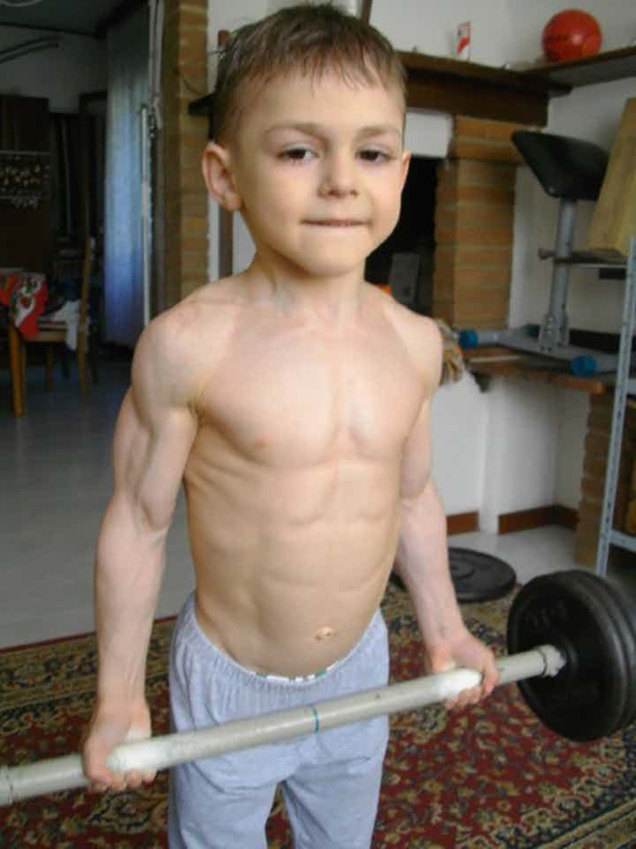 Nguyên nhân của tình trạng cơ bắp phát triển hơn so với bình thường của cậu bé Liam liên quan đến một protein kiềm chế tăng trưởng cơ có tên gọi myostatin. Với việc cơ bắp phát triển quá mức, cơ thể của những người đặc biệt này phải tiêu tốn rất nhiều năng lượng để nuôi chúng.
