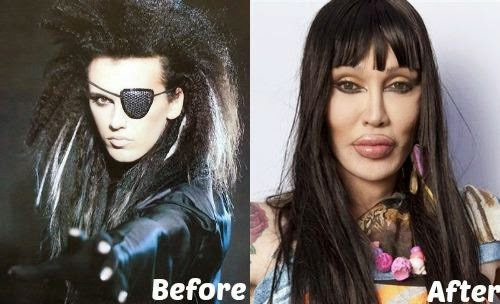 Ngoại hình của nam ca sĩ Pete Burns trước và sau 300 cuộc phẫu thuật như hai người hoàn toàn khác nhau. (Ảnh: Internet)