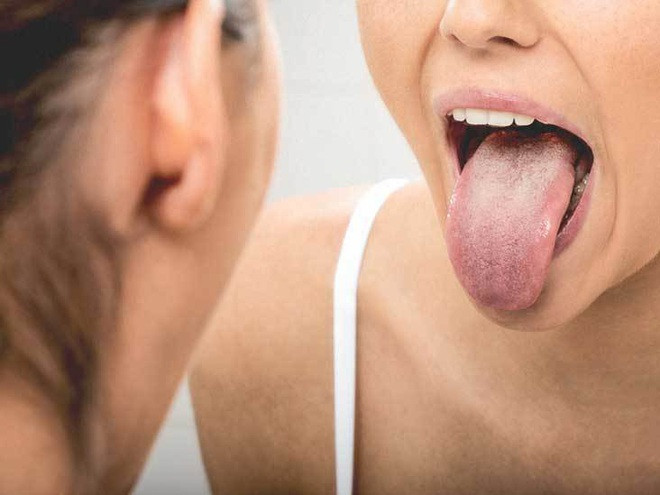 Tựu chung lại, nếu trong cuộc sống hàng ngày, 6 đối tượng trên đây sẽ liên tục gặp phải tình trạng viêm loét miệng, kèm theo đó là các nốt hoặc cục ở miệng, lâu ngày viêm, loét rõ ràng thì phải hết sức cảnh giác, nó có liên quan đến ung thư miệng.
