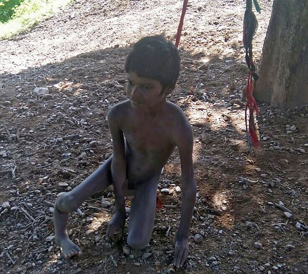 Theo thông tin đăng tải, hai cậu bé đáng thương này lần lượt là Umesh, 8 tuổi, ở Kolyari, tiểu bang Rajasthan, Ân Độ, cậu bé bị khiếm thị, thần kinh không ổn định và Jiva, 11 tuổi, đến từ Baydi, Udaipur, cũng thuộc tiểu bang Rajasthan, cậu bé mắc chứng bại liệt và khuyết tật tâm thần. (Nguồn Dailymail)