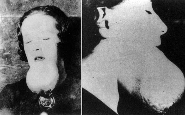 Cuối năm 1927, đầu năm 1928, hàng loạt công nhân nhiễm phóng xạ bao gồm Grace Fryer, Edna Hussman... nộp đơn kiện các công ty. Sau khi cơ quan chức năng và các chuyên gia vào cuộc, sự thật về tác hại của radium đối với sức khỏe con người được làm sáng tỏ.