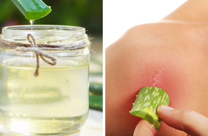 Gel lô hội giúp giảm cháy nắng và chữa lành vết thương. Ngoài ra, nó còn có tác dụng giảm ngứa và kích ứng da. Lấy nửa cốc gel lô hội tươi và sử dụng miếng bông thấm rồi thoa lên da và để khô. Lặp lại 3 lần mỗi ngày.