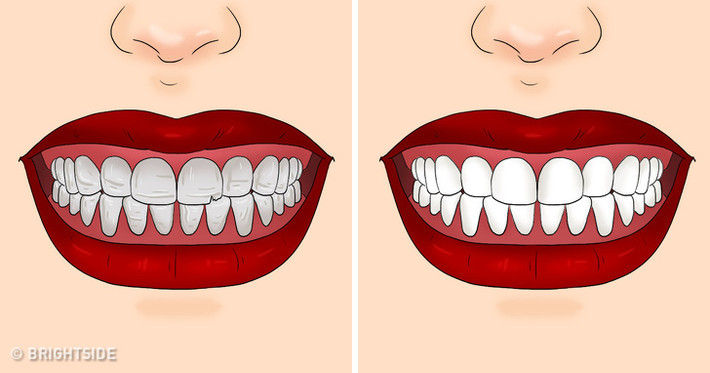 Trong cần tây có một hàm lượng đáng kể chất chống viêm và chống oxy hóa. Những vết viêm tấy trên nướu có thể được xoa dịu nếu chúng ta ăn cần tây đều đặn. Ngoài ra, canxi có trong cần tây còn giúp răng trở nên chắc khỏe và trắng sáng hơn.