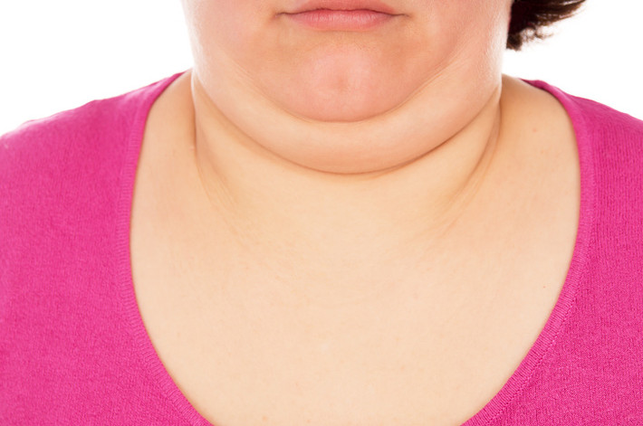 Cổ khó chịu hoặc bị phù lên: Việc sản xuất quá nhiều và thiếu hormone có thể dẫn đến sự mở rộng tuyến giáp khiến cho cổ sưng phù.