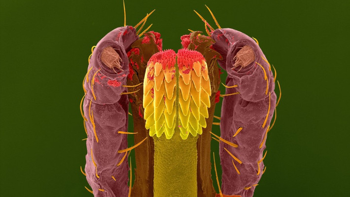 Trong ảnh là bọ ve, mang vi khuẩn gây bệnh Lyme, được tìm thấy trên khắp nước Anh và một số vùng khác thuộc châu Âu và Bắc Mỹ. (Nguồn Sina)