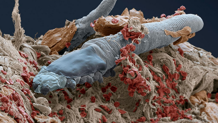 Demodex có thể lây truyền thông qua việc tiếp xúc trực tiếp với tóc hoặc da mặt của người mắc ký sinh trùng. Tuy vậy đến này các nhà khoa học vẫn không chắc chắn về nguyên nhân ban đầu con người bị nhiễm loài ký sinh trùng ghê rợn này. (Nguồn Boredom Therapy) Bạn có thể không biết, nhưng có hàng triệu sinh vật nhỏ bò trên mặt và cơ thể của bạn ngay bây giờ mà không thể nhìn thấy bằng mắt thường. Và bạn biết những gì? Đó có thể là một điều tốt. Bạn có thể không biết, nhưng có hàng triệu sinh vật nhỏ bò trên mặt và cơ thể của bạn ngay bây giờ mà không thể nhìn thấy bằng mắt thường. Và bạn biết những gì? Đó có thể là một điều tốt.