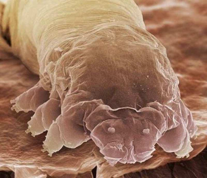 Chân dung một con quái vật ký sinh trùng Demodex khiến nhiều người khiếp sợ. (Nguồn Boredom Therapy)