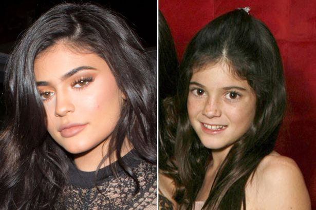 Cô em út Kylie Jenner cũng bị dính nghi vấn sửa mũi và bơm môi khi so sánh hình ảnh của Kylie lúc bé và hiện tại. (Ảnh: Mirror)