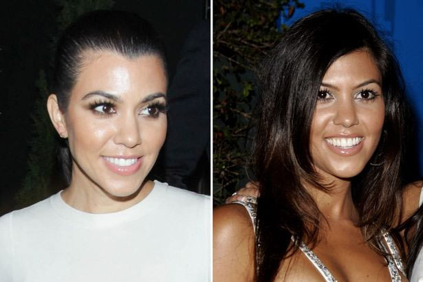 Mũi của Kourtney cũng bị dính nghi vấn phẫu thuật thẩm mỹ bởi nó gọn và cao hơn trước. (Ảnh: Mirror)