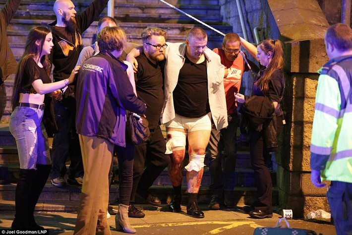 Người bị thương được dìu ra khỏi khu vực Manchester Arena. (Ảnh: LNP)