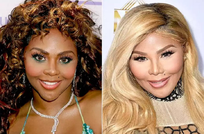 Theo Life & Style, rapper Lil Kim đã biến đổi hoàn toàn khuôn mặt của mình bằng những lần nâng cơ mặt, sửa mũi, tiêm Botox. Rõ ràng không chỉ khuôn mặt của Lil Kim thay đổi mà cả nước da, màu mắt, màu tóc khác lạ của cô cũng khiến cho ngoại hình cô thay đổi hoàn toàn.