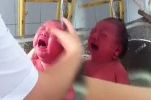 Mấy ngày gần đây, dân mạng Việt ồn ào về một clip tắm trẻ trong bồn rửa bát được cho là diễn ra tại Bệnh viện Phụ sản Hải Phòng. Rất nhiều người phẫn nộ vì cho rằng cách làm đó là không ổn. Trả lời báo chí, bà Đỗ Thị Thu Thủy, Nguyên Giám đốc Bệnh viện Phụ sản Hải Phòng, khẳng định bồn inox trong clip không phải bồn rửa bát mà là bồn tắm cho trẻ sơ sinh, và việc dùng bồn có vòi xả là đúng.