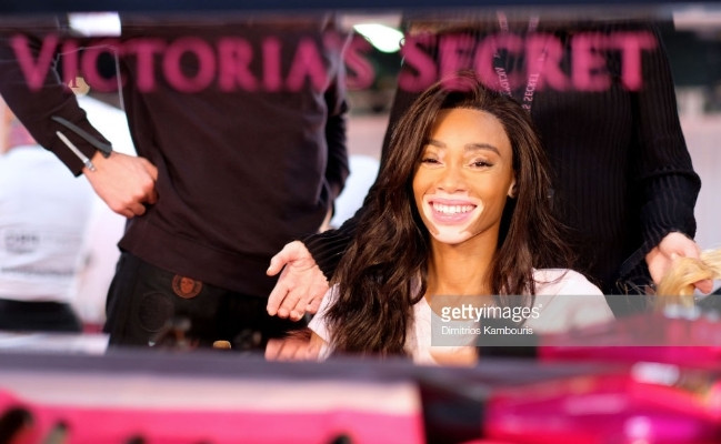 Winnie Harlow là người mẫu bị bạch biến đầu tiên tham gia VSFS.