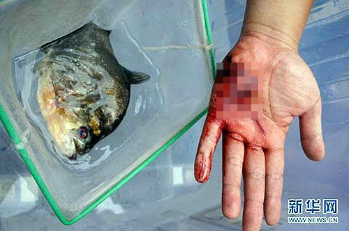 Hàm răng sắc nhọn của loài cá này cho phép chúng có thể cắn đứt cả kim loại, giải quyết một con bò trong vòng 15 phút. Và nếu con người là mục tiêu của chúng, thời gian chỉ là 5 phút. Đã có rất nhiều trường hợp con người bị loài cá tấn công. Và đây là hậu quả.