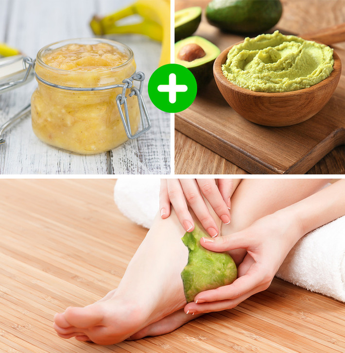 Dưỡng ẩm gót chân bằng chuối và bơ: Trộn một quả chuối và nửa quả bơ trong máy xay để tạo thành hỗn hợp sệt. Bôi nó lên gót chân và để nó trong 20 phút. Rửa chân bằng nước ấm và lau khô bằng khăn mềm. Lặp lại mỗi ngày cho đến khi gót chân mềm mại trở lại.