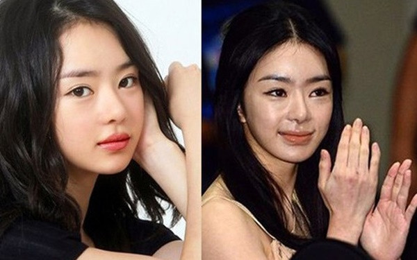 Diễn viên Seo Woo được mệnh danh là búp bê của làng giải trí xứ Hàn bởi vẻ đẹp trong sáng, bầu bĩnh đáng yêu. Trong quá khứ, Seo Woo được cho là đã nâng mũi, cắt mắt, bơm môi và tiêm botox. Lạm dụng “dao kéo” khiến cô trở thành thảm họa thẩm mỹ với gương mặt sưng vù, không cân xứng.