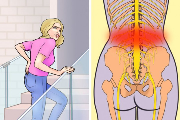 6. Thường xuyên đi cầu thang bộ: Dù đi cầu thang bộ được coi là thói quen lành mạnh nhưng đây không phải phương pháp tập luyện để duy trì vóc dáng tốt nhất nếu bạn đang bị đau thắt lưng. Người bị đau đầu gối hoặc đau lưng nên hỏi ý kiến bác sĩ trước khi tập thể dục bằng cách leo cầu thang bộ.