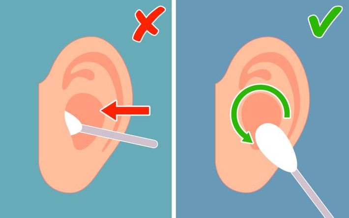 3. Ráy tai có chức năng như một chất làm sạch: Nhiều người trong chúng ta luôn nghĩ rằng cần làm sạch ráy tai hàng ngày vì lý do vệ sinh. Tuy nhiên, khoa học chứng minh rằng mọi thứ hoàn toàn ngược lại. Ráy tai tự nó làm sạch ống tai của chúng ta và bảo vệ nó khỏi nhiễm trùng. Việc loại bỏ ráy tai gây ra nhiều tác hại hơn là có lợi cho chúng ta, vì vậy tốt hơn là chỉ nên làm sạch nó từ bề mặt của tai.