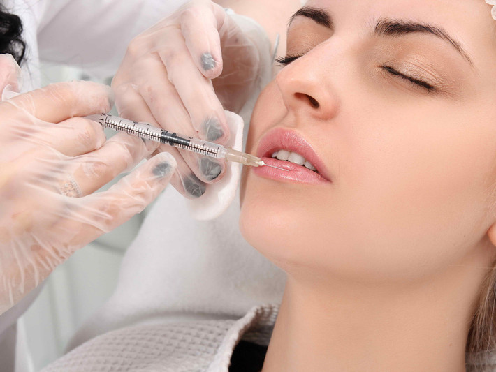 Tiêm chất axit hyaluronic (chất làm đầy) vào môi hiện đang là phương pháp làm đẹp được nhiều chị em ưa chuộng và trở nên phổ biến hơn. Tuy nhiên, ít ai nhận thức được rằng cách làm đẹp này tiềm ẩn rất nhiều rủi ro.