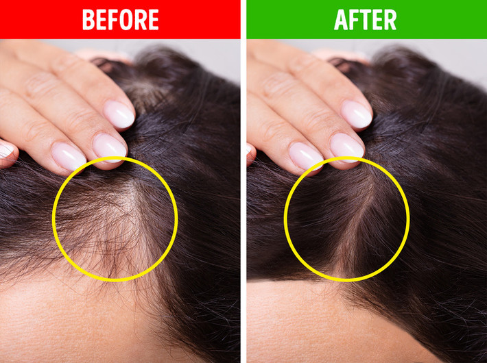 Sử dụng xịt dưỡng làm dày tóc: Nếu bạn không có thời gian để tạo kiểu tóc, bạn hãy dùng xịt làm dày tóc. Loại sản phẩm này cho tóc vào nếp và trở nên bóng mượt đầy sức sống. Tóc cũng dày và đầy đặn hơn. Ảnh: BS. Video "Bí quyết làm đẹp của sao Việt". Nguồn: VTC.