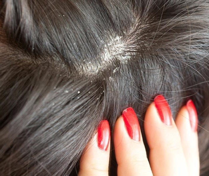 Ngoài ra, cỏ hôi còn có thể dùng để nấu nước gội đầu trị gàu tóc và giúp chị em phụ nữ giảm tình trạng rong huyết sau sinh rất tốt khi kết hợp với các vị thuốc khác đúng cách. Ảnh: Làm đẹp cùng bạn.