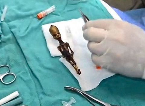 Do vậy, các chuyên gia đã tiến hành một số nghiên cứu nhằm giải mã những bí ẩn về Ata - bộ xương nghi người ngoài hành tinh này.