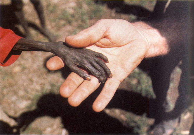 Cánh tay cậu bé chết đói đặt trên bàn tay của một nhà truyền giáo ở Uganda năm 1980 khiến nhiều người nhói lòng, đau xót. Bức ảnh này nói lên thực trạng đau lòng xảy ra trong thập niên 80 của thế kỷ 20 khi cứ 5 người Uganda thì 1 người chết đói.