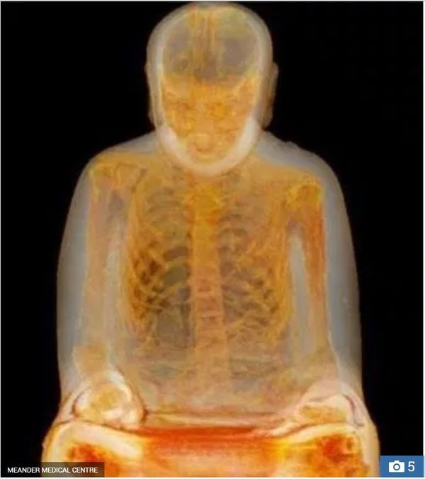 Kết quả kiểm tra cho thấy thiền sư Zhanggong Liuquan chuyên tâm thiền định cho đến khi qua đời.
