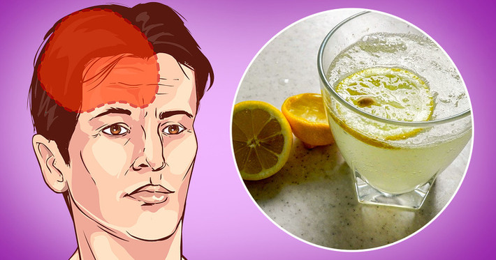 8. Nước chanh: Chứa nhiều vitamin C, nước chanh được biết đến với nhiều lợi ích sức khỏe, trong đó có tác dụng chống đau nửa đầu. Bất cứ khi nào bạn đang bị đau đầu nhói, chỉ cần pha một ít nước chanh vào cốc nước, thêm 2 muỗng cà phê muối và uống. Cốc nước “thần kỳ” này sẽ giảm viêm và làm cho bạn cảm thấy tốt hơn nhanh chóng. Ảnh: BS.