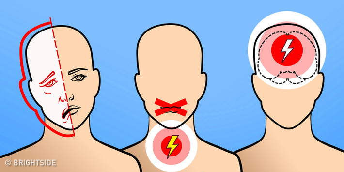 Khó nói hoặc nói nhịu: Người bị đột quỵ sẽ cảm thấy khó khăn trong giao tiếp, phát âm hoặc không nói được, khả năng nhận biết lời nói của người khác cũng chậm hơn.