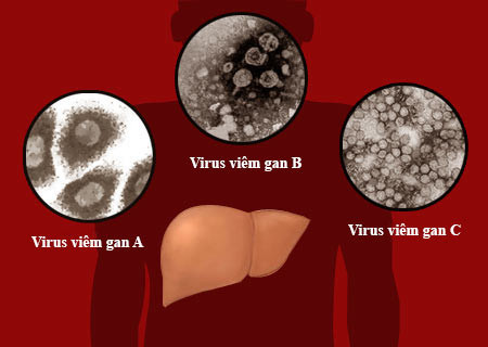 Khi bệnh tiến triển đến thời kỳ tiền hôn mê, người bệnh sẽ có ý thức lẫn lộn, khó ngủ, hành vi thất thường. Trong giai đoạn này, những triệu chứng của giai đoạn 1 nặng thêm, năng lực định hướng và năng lực hiểu giảm sút, ý nghĩ về thời gian, địa điểm, con người hỗn độn. Bệnh nhân nói năng không rõ ràng, không viết lách được, cử chỉ bất thường…