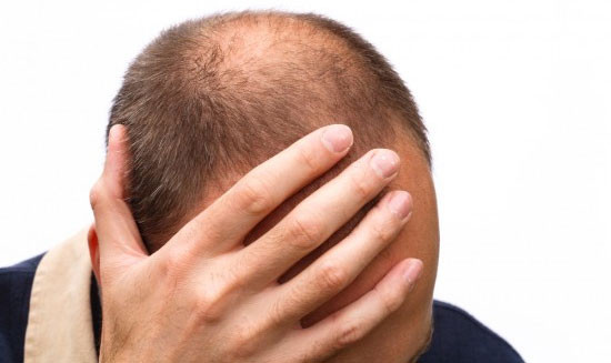 Những người sử dụng thuốc nở cơ có nguy cơ bị hói đầu rất cao vì thuốc gây ra tình trạng rụng tóc khá nghiêm trọng. Nhưng có một điều trái ngược hoàn toàn với tình trạng rụng tóc ở trênu là lông cơ thể mọc càng nhiều hơn.