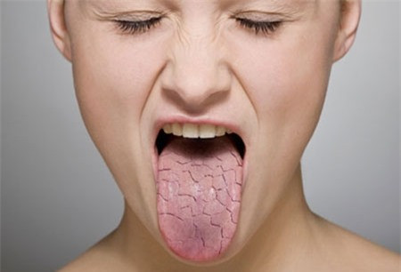 Ngoài ra, gừng có tính cay, nóng, ăn quá nhiều loại mứt này sẽ gây mất nước khô khan trong cơ thể khiến bạn bị nóng trong khó chịu.