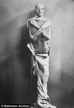 Thêm nữa, ở chân của pharaoh Ramesses III, các chuyên gia phát hiện các xương ngón chân của ông bị gãy. Đặc biệt, ngón chân cái được cho là bị chặt đứt bằng rìu. Những tổn thương nghiêm trọng này được che giấu thông qua lớp nhựa thông dày trong quá trình ướp xác.