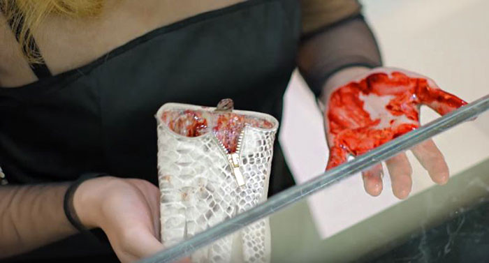Khách hàng phát hoảng với chiếc giày đầy máu me.