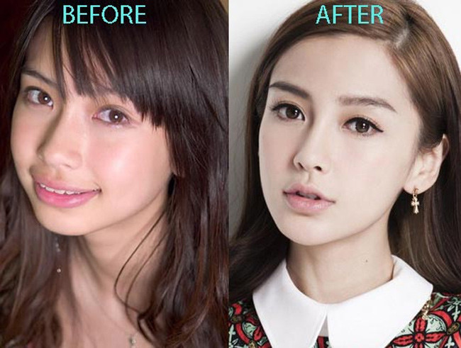 Từ một cô gái có ngoại hình xấu xí, Angelababy đã đại tu cả khuôn mặt để có được vẻ ngoài xinh xắn như hiện giờ. Nhiều người cho rằng, nhờ có phẫu thuật thẩm mỹ mà người đẹp sinh năm 1989 mới thực sự đổi đời và hạ gục được anh chàng điển trai Huỳnh Hiểu Minh.