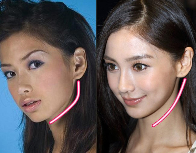 Theo thời gian, nhiều cư dân mạng nhận định, Angelababy đã thay đổi diện mạo bất ngờ nhờ những cuộc trùng tu nhan sắc từ nâng mũi, gọt cằm, bơm môi, nâng ngực. (Ảnh: Internet)