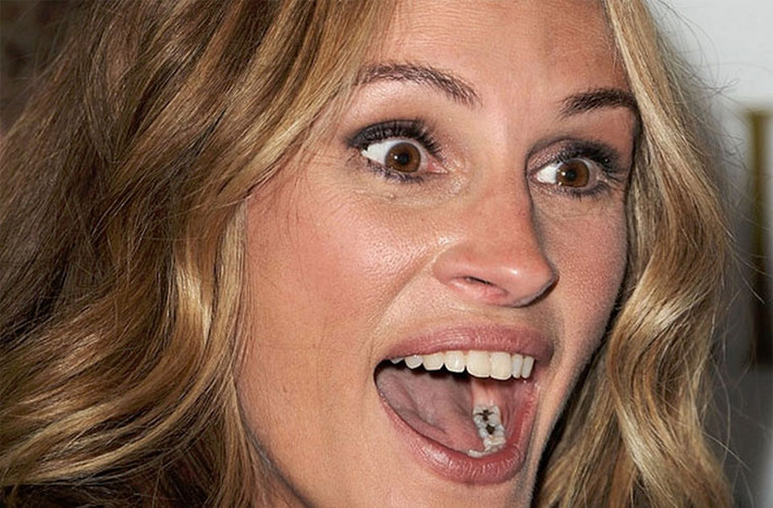 Hình tượng “Người đàn bà đẹp” của Julia Roberts bị mất đi vài phần khi cô để lộ ra vài chiếc răng sâu đen.
