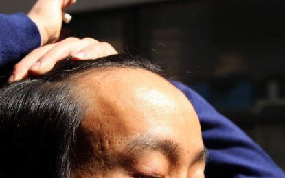 Bổ sung thêm sắt: Một trong những nguyên nhân gây tình trạng hói đầu còn là cơ thể bị thiếu chất sắt. Khi máu thiếu sắt, phần chân tóc cũng sẽ bị ảnh hưởng, trở nên yếu và dễ bị tổn thương hơn.
