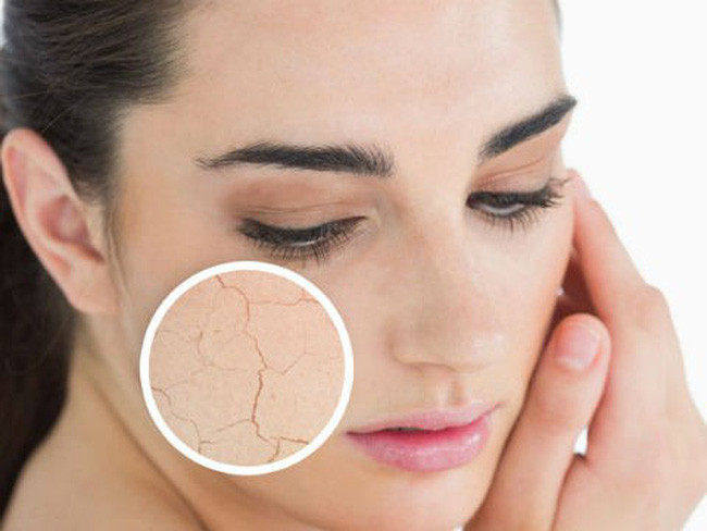 Da bị khô: Khi da bạn trở nên khô hơn bình thường, hãy quan tâm hơn đến dinh dưỡng bạn nhé, đây có thể do bạn đang bị thiếu canxi và vitamin đấy, hãy tìm cách bổ sung ngay nhé.